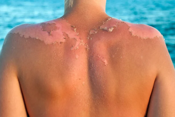 Your Skin Is Not the Same as Last Month Here's Why